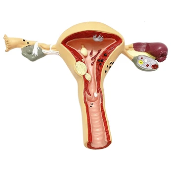 Модел на матката и яйчниците на човека, модел на женския репродуктивен орган, Женски полов орган, Анатомический материал за обучение медицина