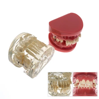 Грижи за устната кухина, модел на зъбите, демонстрация на ортодонтски модели на зъбите, обучение, комуникация лекар и пациент, показване на резултати