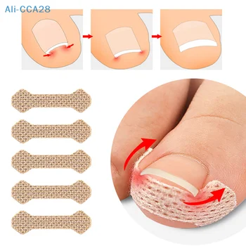 Лепенки за нокти и За лечение на паронихии С корректорами за нокти и определящи неща За възстановяване, Грижа за Бурсит на палеца на стъпалото.